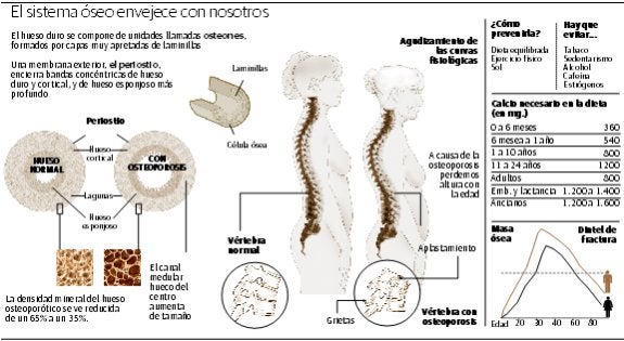 fractora de costillas complicaciones de diabetes